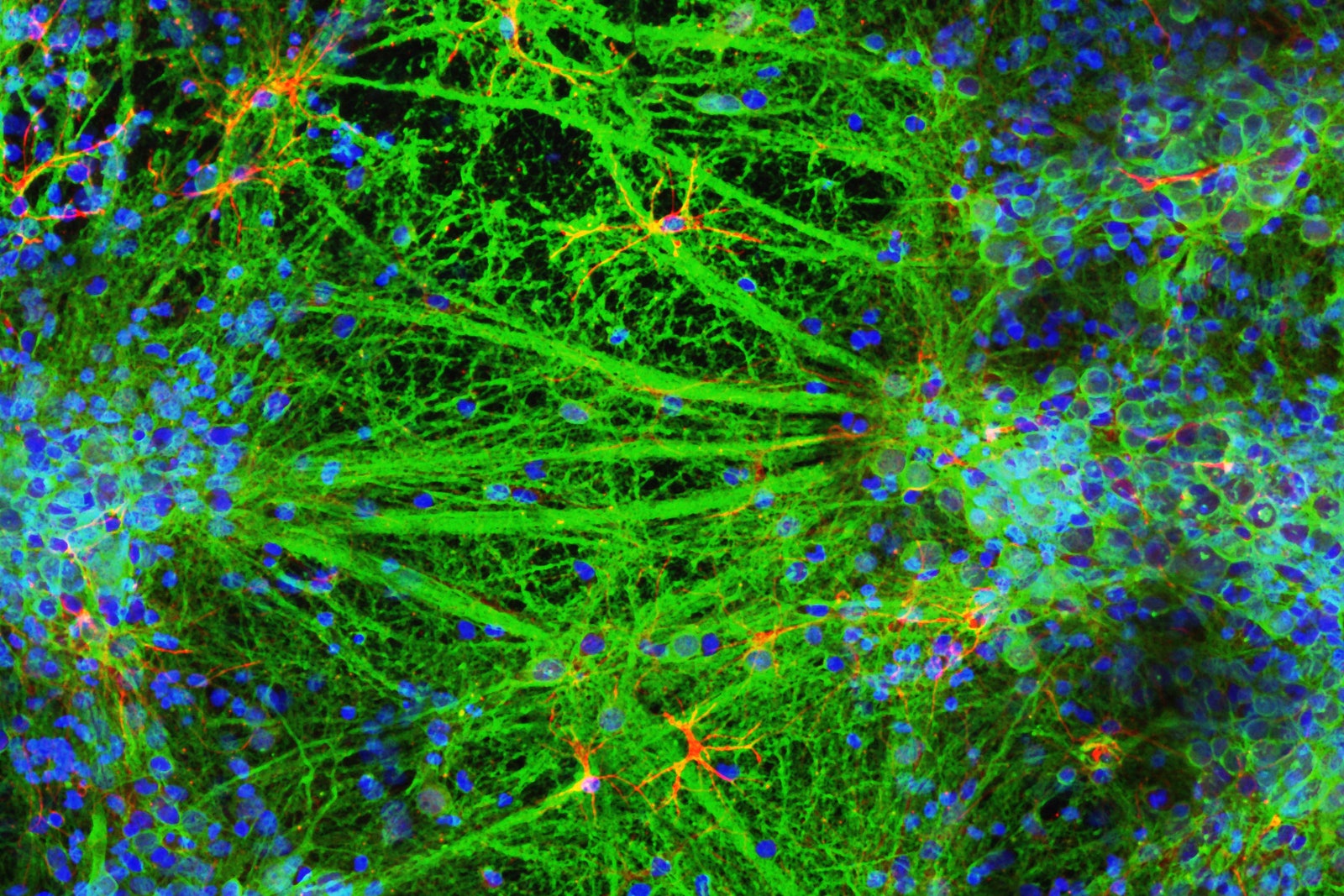 A Lab Just 3D-Printed a Neural Network of Living Brain Cells